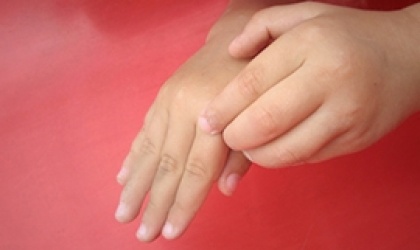 Frederique (5) weer vrolijk zonder eczeem